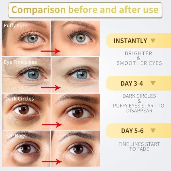 Adesivos para os olhos – 30 pares – Máscara dourada 24K – tratamentos para olhos inchados e olheiras, reduzem as bolsas sob os olhos e rugas suaves, almofadas para cuidados com a pele - Imagem 3