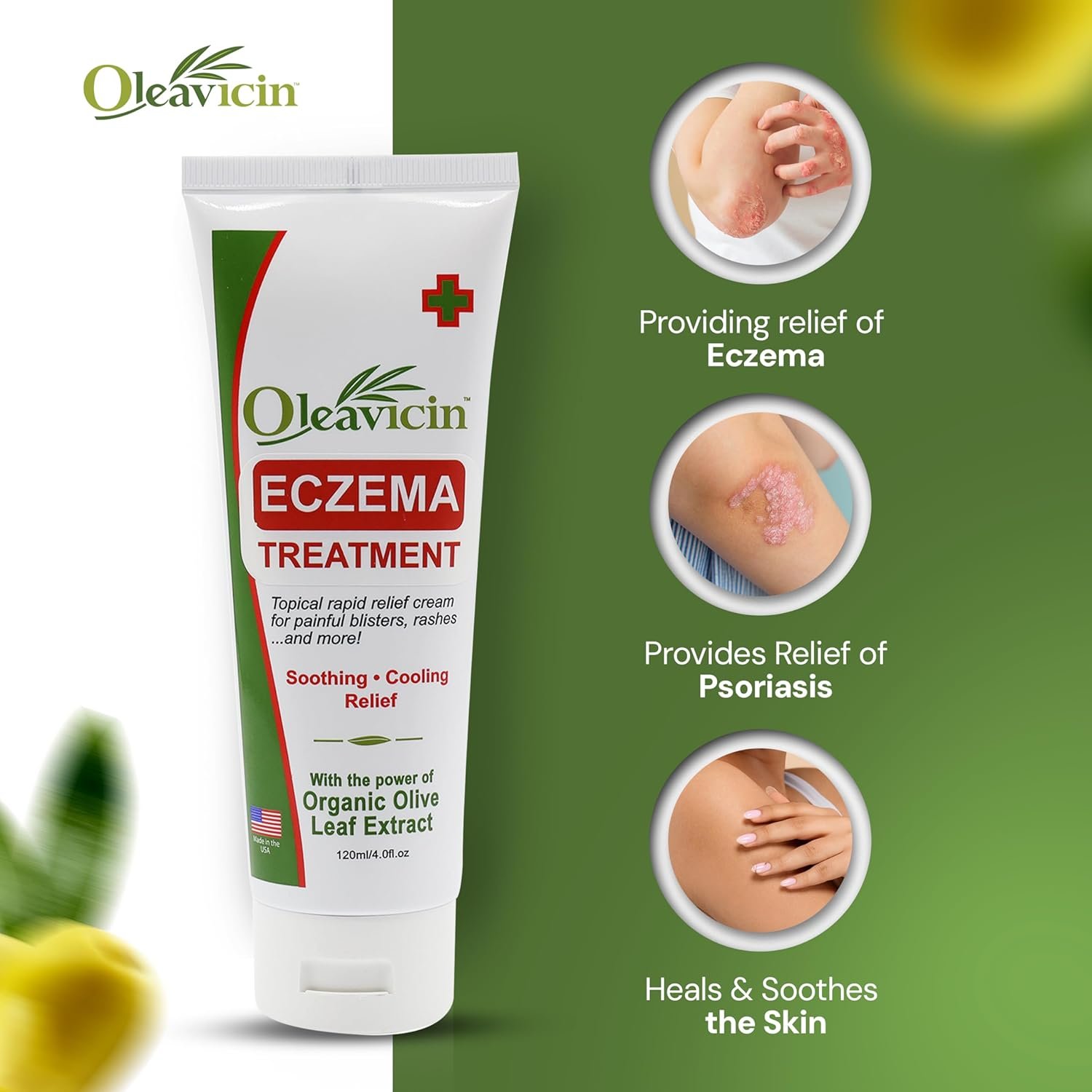 Oleavicin Creme de tratamento de eczema – livre de esteroides, extrato orgânico de folha de oliveira, calmante e hidratante para todos os tipos de pele, crianças e adultos 5 Oleavicin Creme de tratamento de eczema – livre de esteroides, extrato orgânico de folha de oliveira, calmante e hidratante para todos os tipos de pele, crianças e adultos - Imagem 5
