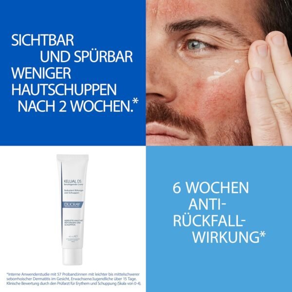 Ducray Kelual Creme Anti Descamação Facial 40ml - Imagem 2
