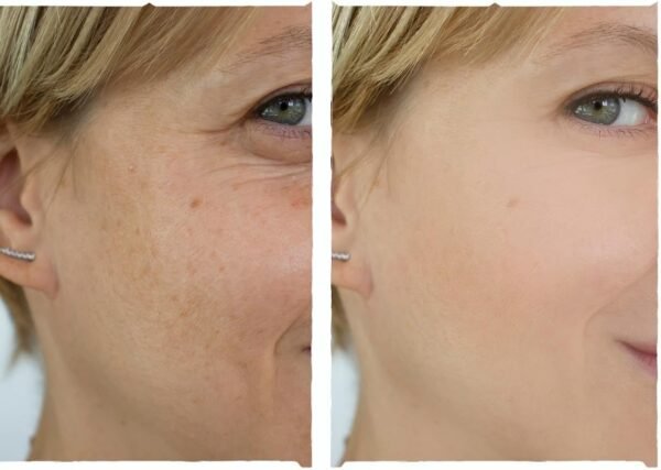Serum Facial Hidratante Clareador Manchas Escuras Nianamida 30ml - Imagem 3