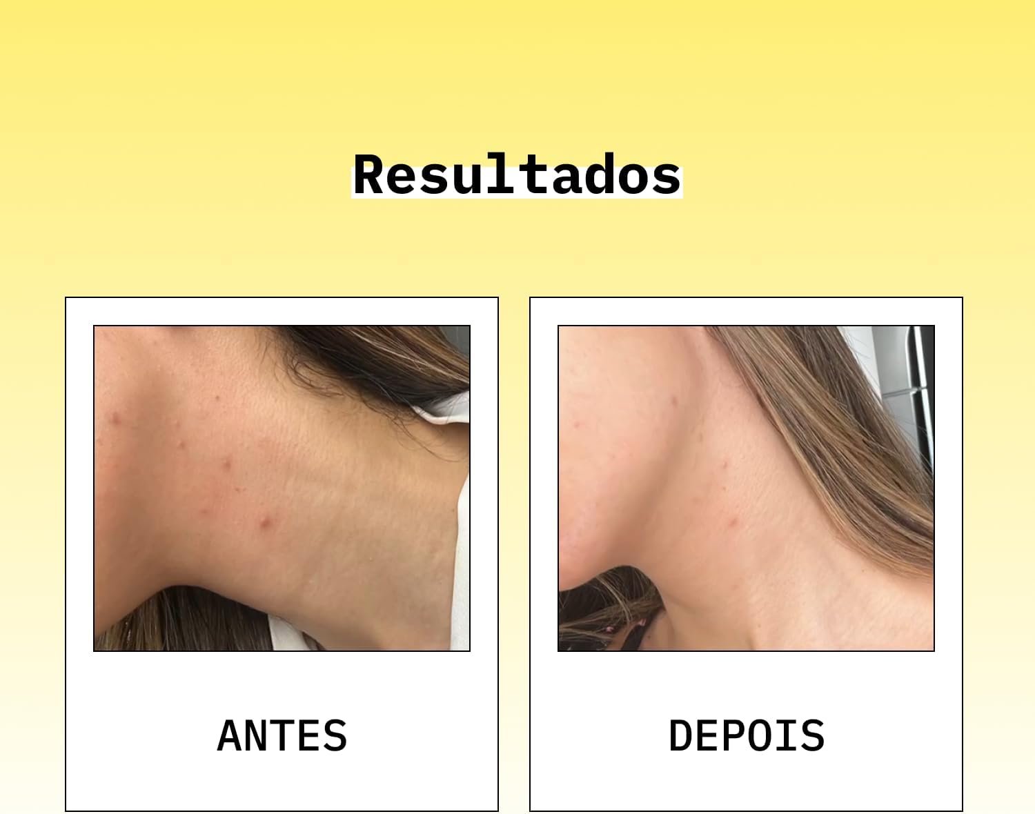 Hidratante Facial Antioxidante Vegano e Biodegradável 30ml 4 Hidratante Facial Antioxidante Vegano e Biodegradável 30ml - Imagem 4