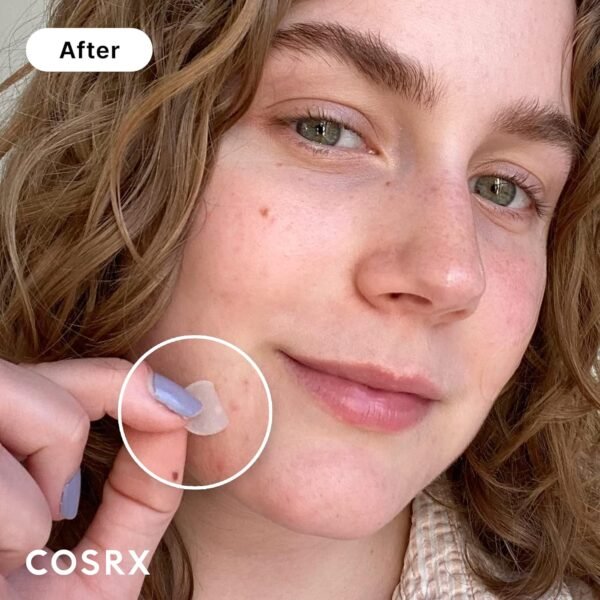 Cosrx (Pacote com 3) Patch Mestre de Espinha de Acne - Imagem 2