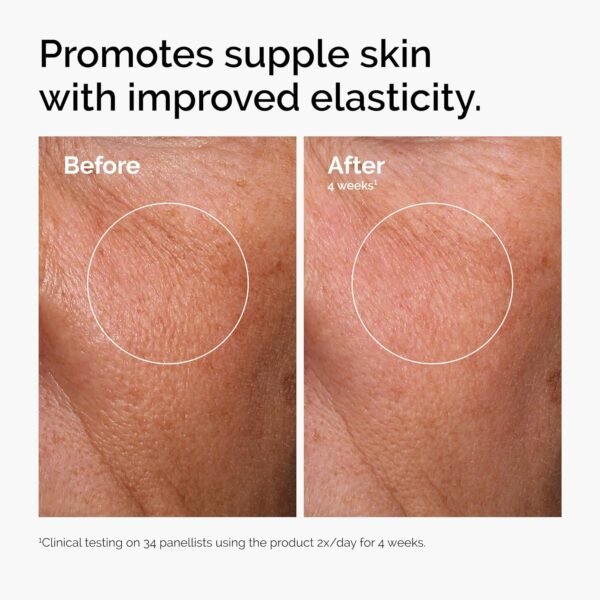 The Ordinary, Ácido Hialurônico 2% + B5 - Imagem 2
