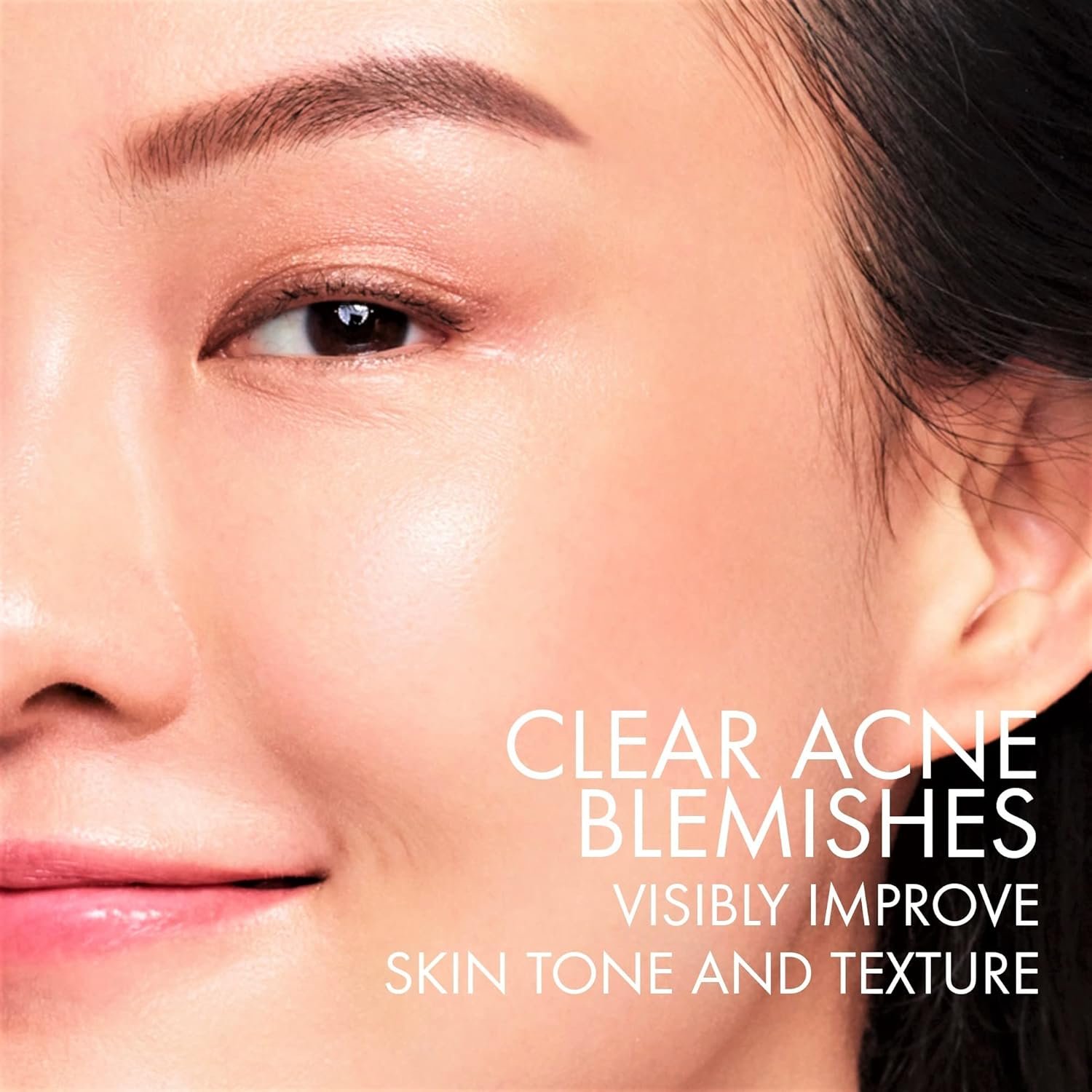 Sérum Antioleosidade e Antiacne Vichy Normaderm Double Correction, Correção de Marcas e Manchas da Acne, com Ácido Salicílico e Ácido Sarcosinico 50G 3 Sérum Antioleosidade e Antiacne Vichy Normaderm Double Correction, Correção de Marcas e Manchas da Acne, com Ácido Salicílico e Ácido Sarcosinico 50G - Imagem 3