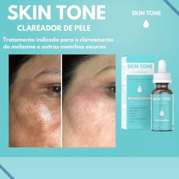 Sérum Clareador Facial Skin Tone Manchas Melasma Sardas Acne Estrias Rugas 60ml - Imagem 4