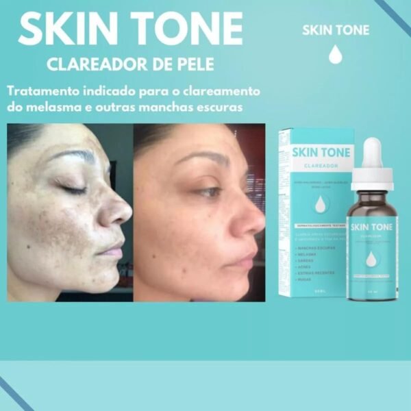 Sérum Clareador Facial Skin Tone Manchas Melasma Sardas Acne Estrias Rugas 60ml - Imagem 5