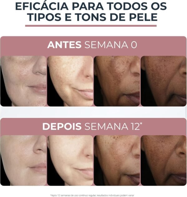 Anti-Pigment Dual Serum Facial com Thiamidol, 30ml, Textura Leve, Uso Dia e Noite - Imagem 2