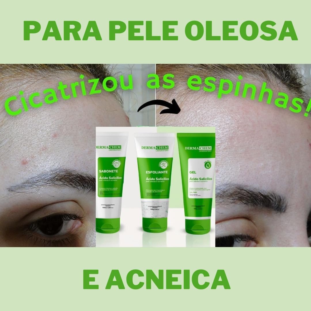 Kit Skincare Anti Acne e Oleosidade Sabonete + Esfoliante + Gel Hidratante + Serum Efeito Secativo Dermachem 2 Kit Skincare Anti Acne e Oleosidade Sabonete + Esfoliante + Gel Hidratante + Serum Efeito Secativo Dermachem - Imagem 2