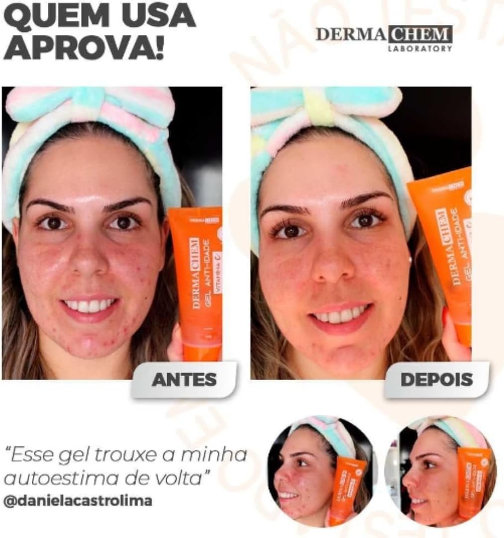 Kit Skincare Vitamina C Anti Idade + Sérum Clareador - 4 Itens 90% de EFICÁCIA COMPROVADA 2 Kit Skincare Vitamina C Anti Idade + Sérum Clareador - 4 Itens 90% de EFICÁCIA COMPROVADA - Imagem 2