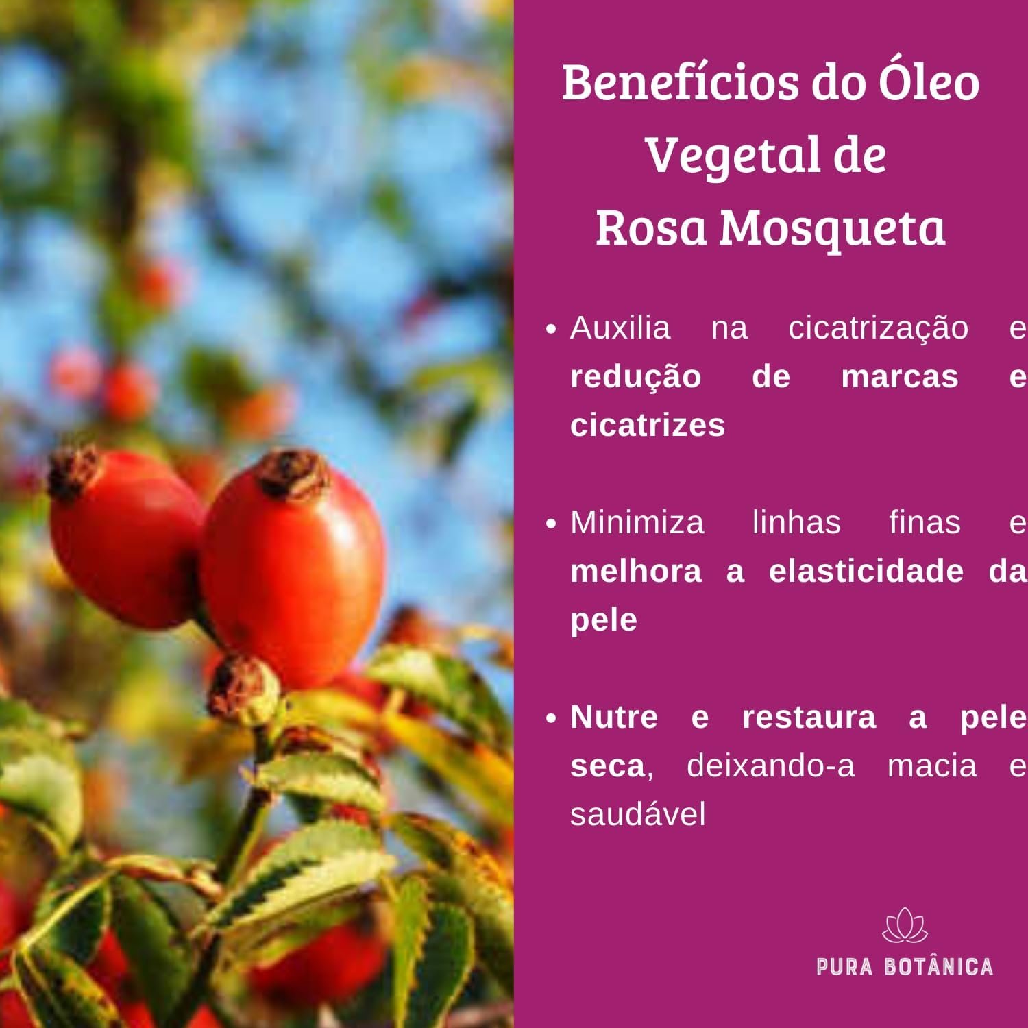 Óleo Vegetal de Rosa Mosqueta 100% Puro, Natural, Massagem, Aromaterapia, Cabelo, Pele Pura Botânica 2 Óleo Vegetal de Rosa Mosqueta 100% Puro, Natural, Massagem, Aromaterapia, Cabelo, Pele Pura Botânica - Imagem 2