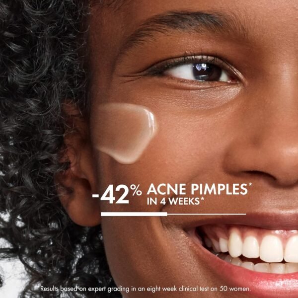 Sérum Antioleosidade e Antiacne Vichy Normaderm Double Correction, Correção de Marcas e Manchas da Acne, com Ácido Salicílico e Ácido Sarcosinico 50G - Imagem 2