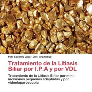 Tratamiento de la Litiasis Biliar por I.P.A y por VDL: Tratamiento de la Litiasis Biliar por mini-incisiones pequeñas adaptadas y por videolaparoscopia